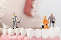 【健康解碼】洗牙會損害牙齒嗎？